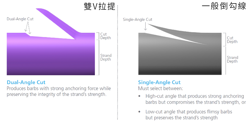 雙V埋線拉提比較