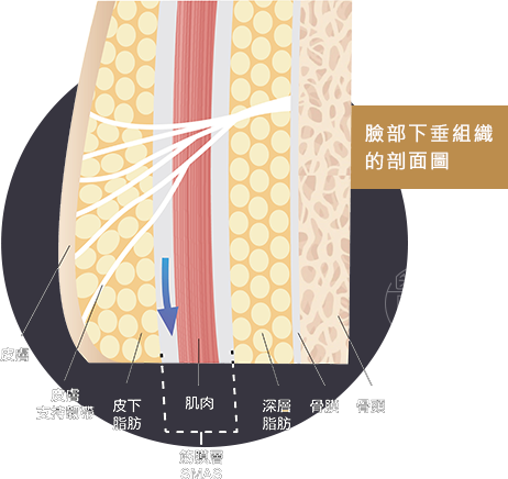 電音雙波拉皮拉提臉部老化肌膚剖面圖