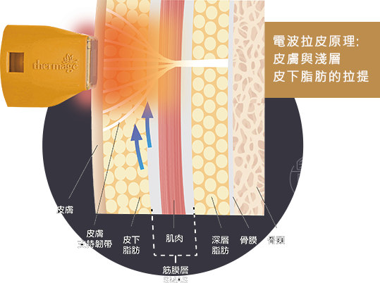 電波拉皮作用在脂肪層皮膚支持韌帶