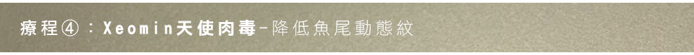 多重雷射/填充應用案例